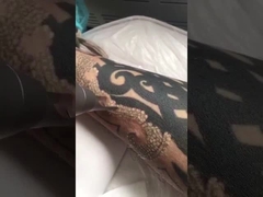 mesin laser kedua pico untuk menghilangkan tato